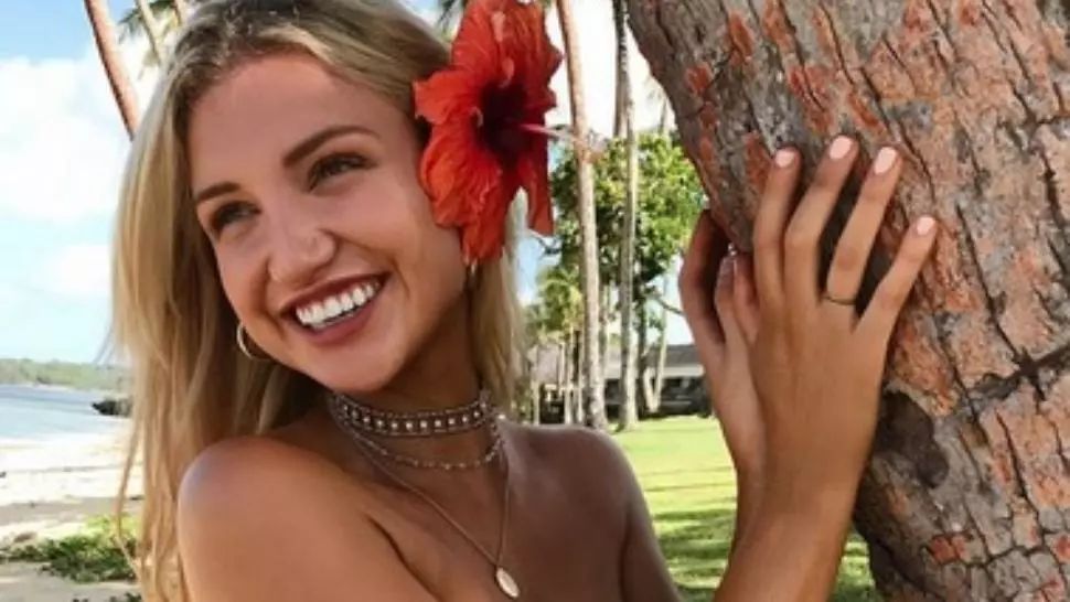 Poza ca un corp perfect, dar şi-a arătat cicatricea. Ce a păţit în secunda următoare a şocat. Oribil!