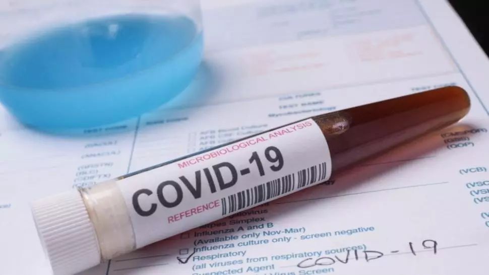 Doi cetățeni străini care lucrează în Slatina, infectați cu noul coronavirus