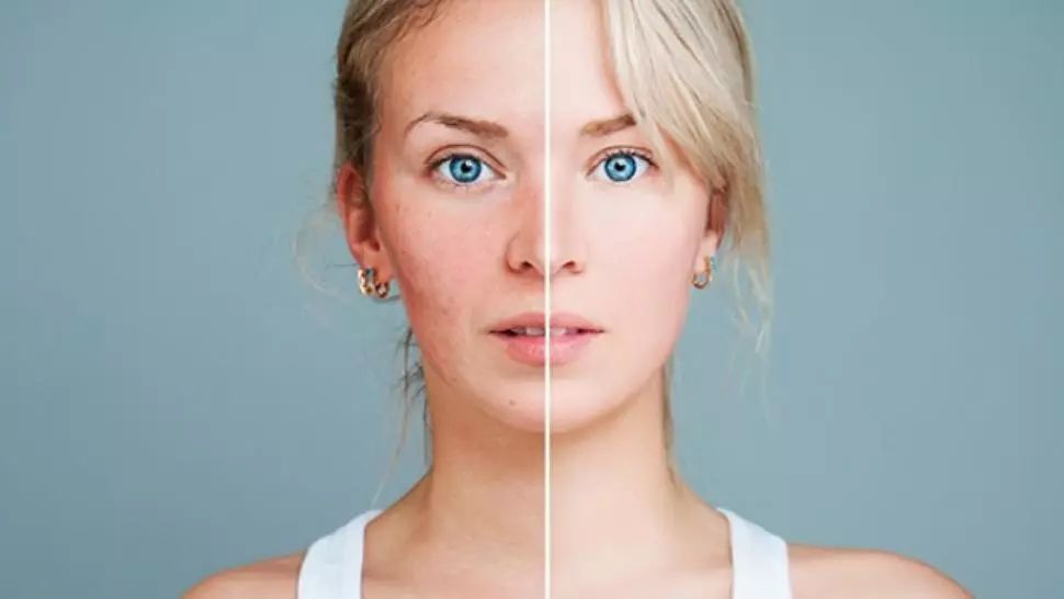 Boala fără leac. Primele semne apar pe faţă şi trădează afecţiunea extrem de gravă