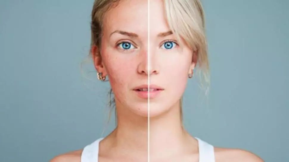 Boala fără leac. Primele semne apar pe faţă şi trădează afecţiunea extrem de gravă