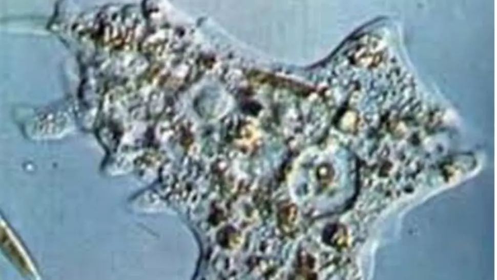 Alertă în Florida: Caz rar de infecție cu o amibă care se hrănește cu creierul uman