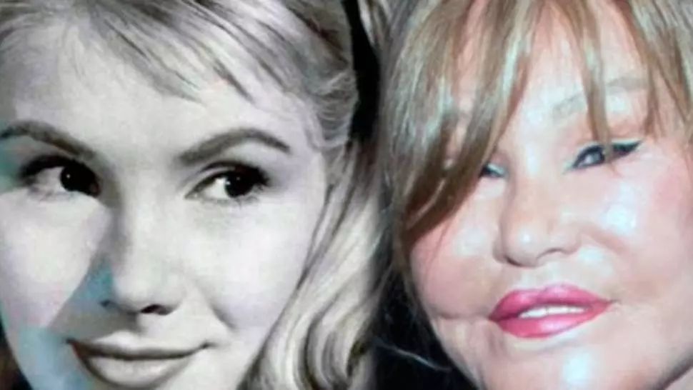 Femeia care a visat să aibă un chip de felină. Operațiile estetice au măcelărit-o. Ireal! 