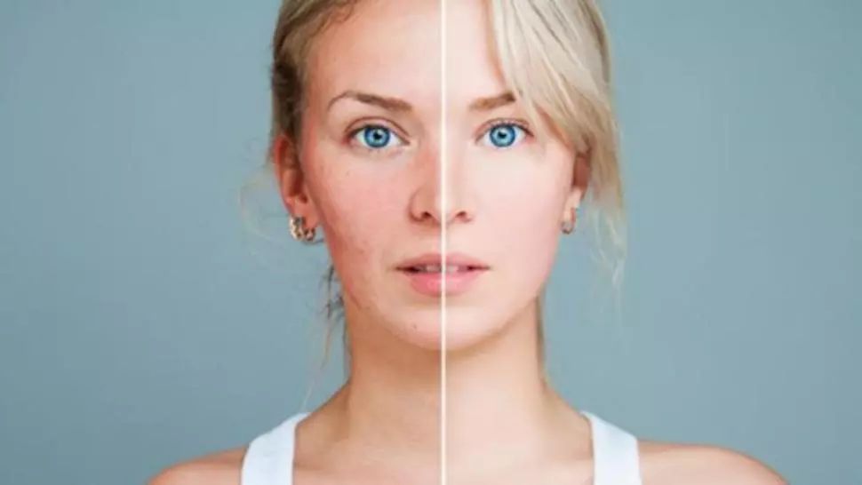 Boala fără leac. Primele semne apar pe faţă şi trădează afecţiunea extrem de gravă