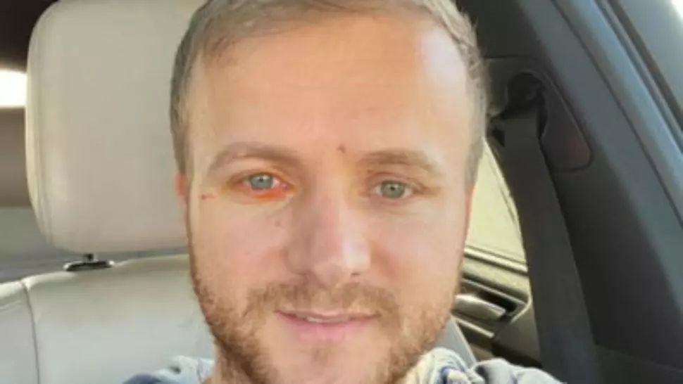 Activistul de mediu Daniel Bodnar, rănit grav într-un accident rutier. Bărbatul nu-și mai simte picioarele. Șocant cum arată mașina după impact