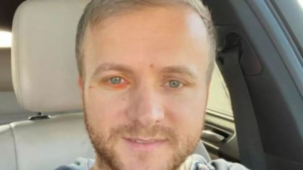 Activistul de mediu Daniel Bodnar, acuzații grave: radiografie la piciorul greșit, după accident 