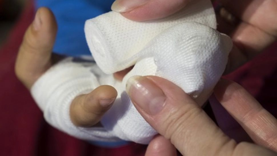 Scandal la cel mai mare spital de copii din România! Spitalul „Grigore Alexandrescu” riscă să piardă finanțarea de la Banca Mondială pentru marii arși