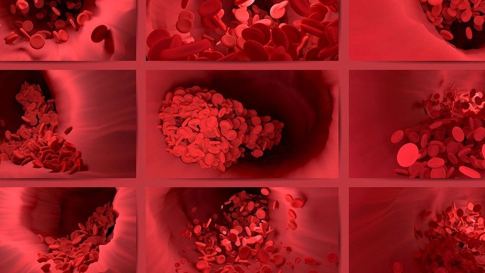 Franța, anunț îngrijorător: Există un RISC „rar” de TROMBOZĂ după vaccinarea COVID-19 cu AstraZeneca. CÂTE cazuri au fost raportate