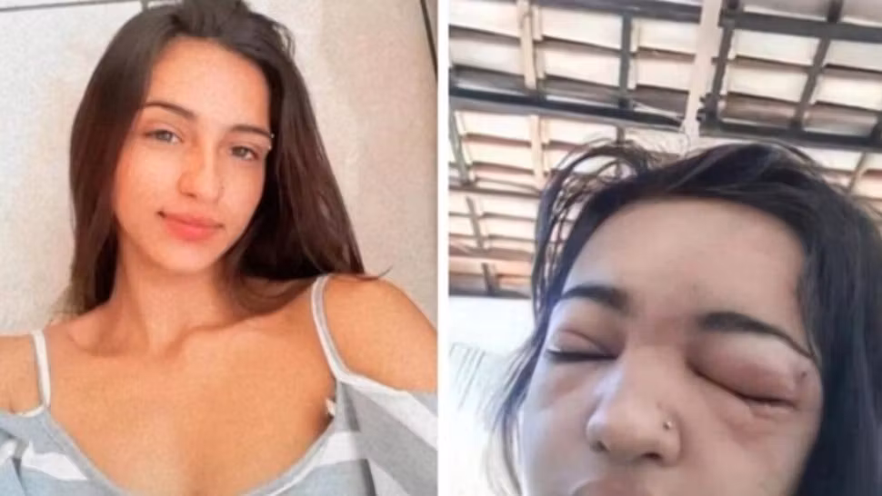 O adolescentă a murit după ce și-a pus singură piercing în sprânceană