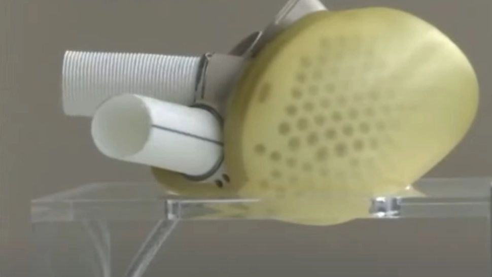 Premieră: A fost făcut transplantul cu o inimă ARTIFICIALĂ. Cum funcționează