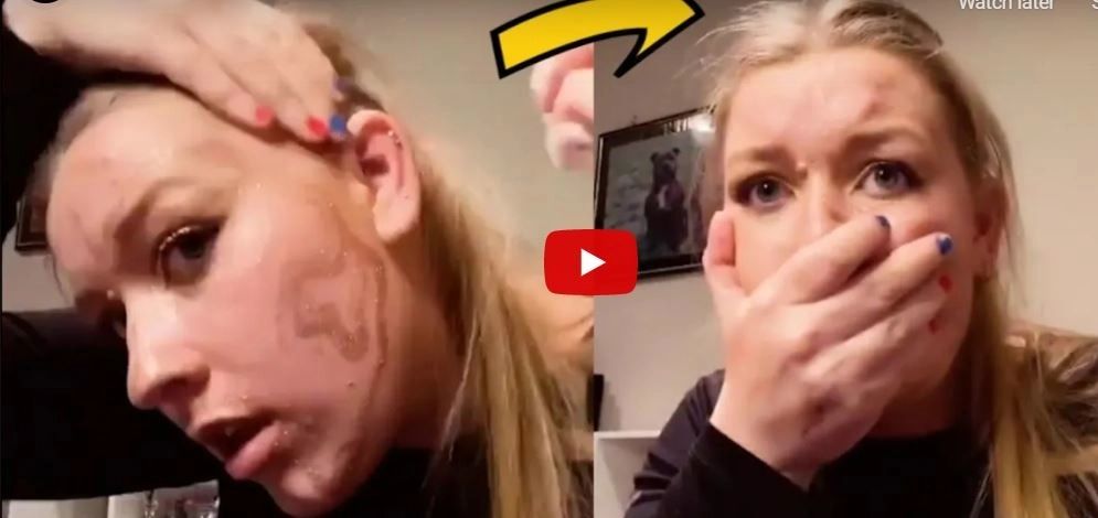 VIDEO – A făcut un experiment văzut pe internet și a rămas cu urme permanente pe față – A regretat amarnic prostia făcută