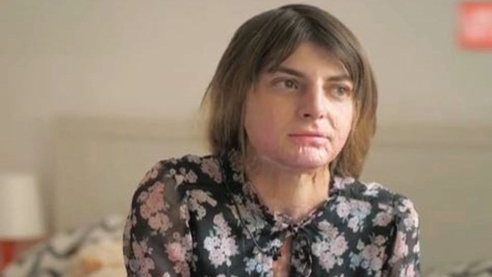 Fata din Mehedinți incendiată de un criminal s-a recuperat după atac – Dezvăluiri emoționante