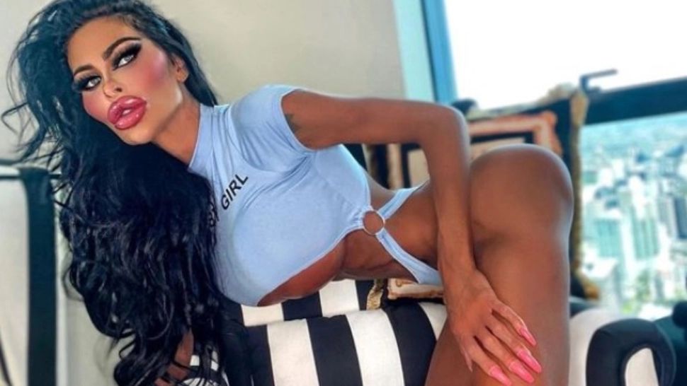 Asistenta care a uimit lumea medicală: după 5 operații estetice, vrea să-și dubleze sânii - FOTO