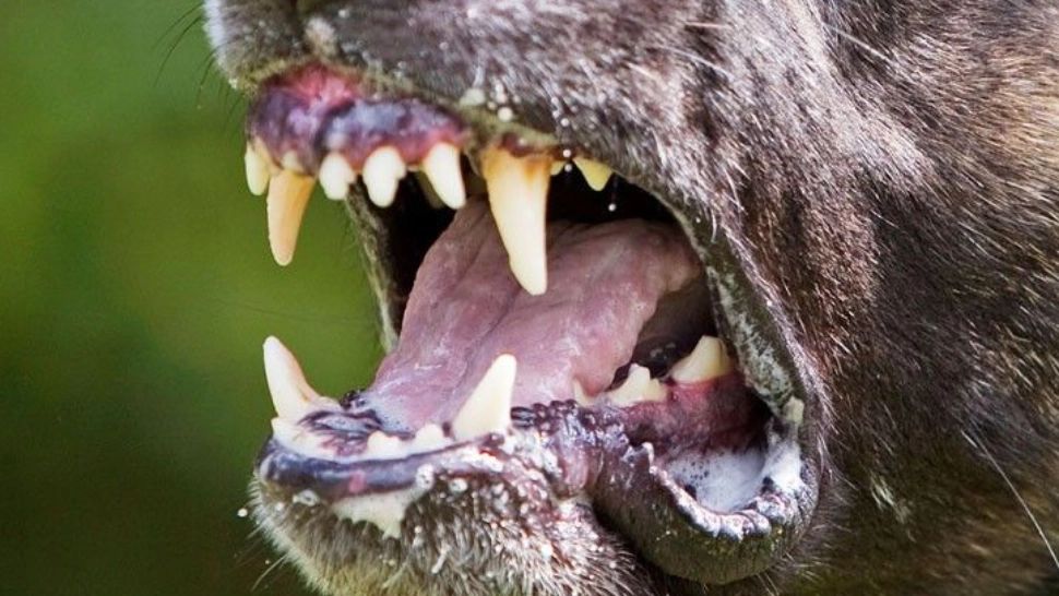 Întâmplare ÎNFIORĂTOARE! O fetiţă de 4 ani, atacată și mușcată de un PITBULL