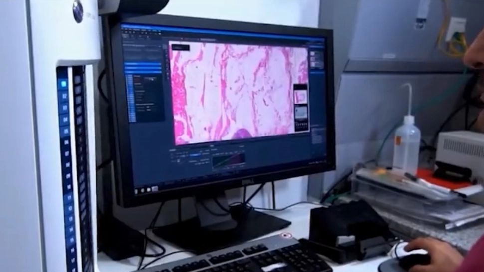 Peste 15 vaccinuri anti-CANCER, aflate în studii clinice! Ce spun experții