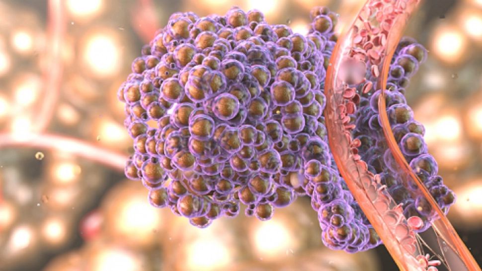 Alimentul care răspândește cancerul în tot corpul. Renunță la el cât mai rapid