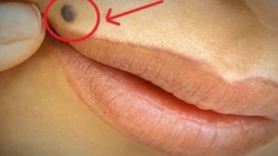 Şi tu ai această aluniţă în colţul gurii? Iată ce spune asta despre tine
