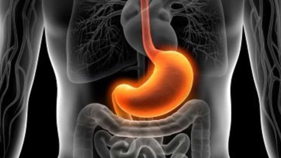 Alimentele interzise în GASTRITĂ. Când devine o afecțiune periculoasă și este nevoie de biopsie