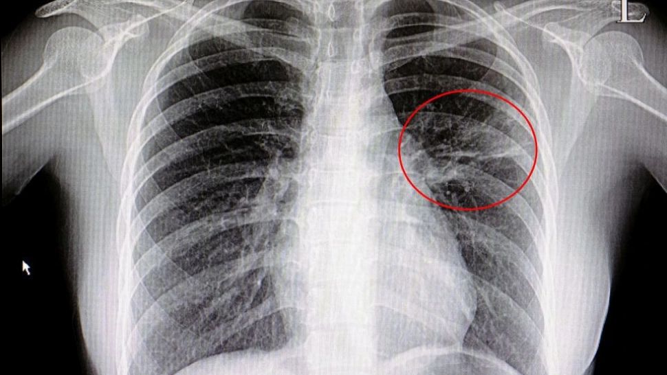 Amestecul natural din 3 plante care îţi curăţă plămânii. Şi tu le ai în casă!