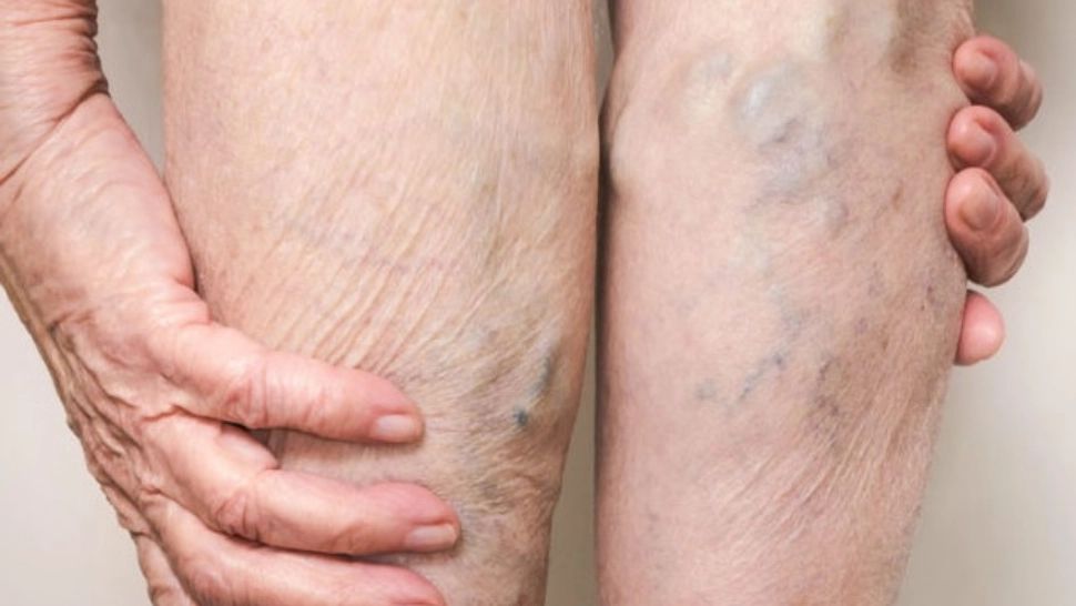 "Antibioticul natural" care face minuni pentru circulație