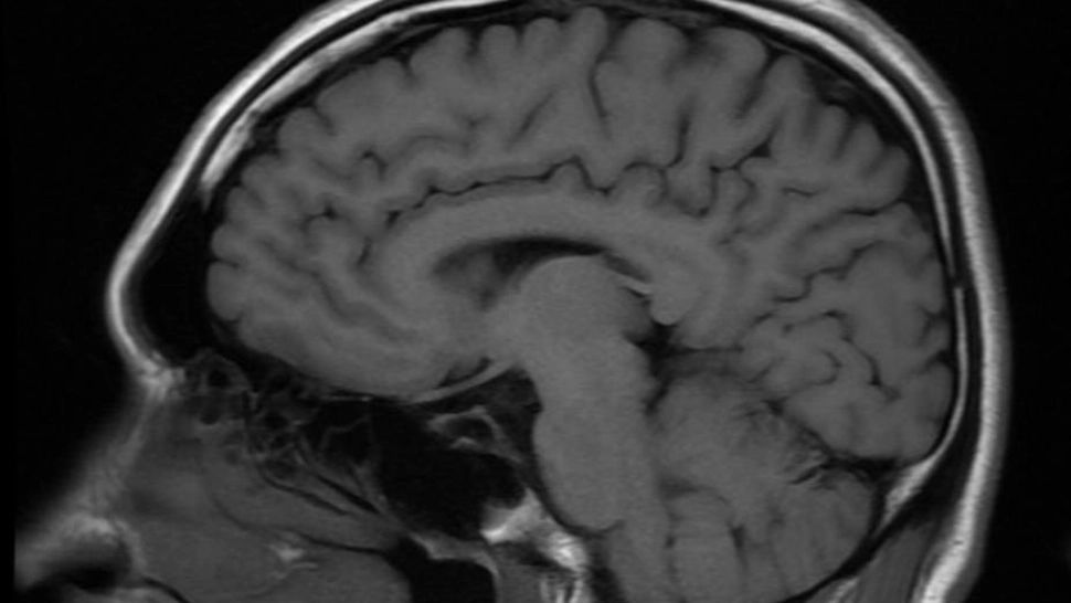 O boală neurologică misterioasă face ravagii printre tinerii canadieni. Ipotezele sunt HALUCINANTE