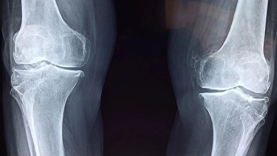 Alimentul minune care întărește oasele, contribuie la sănătatea inimii și ține în frâu diabetul 