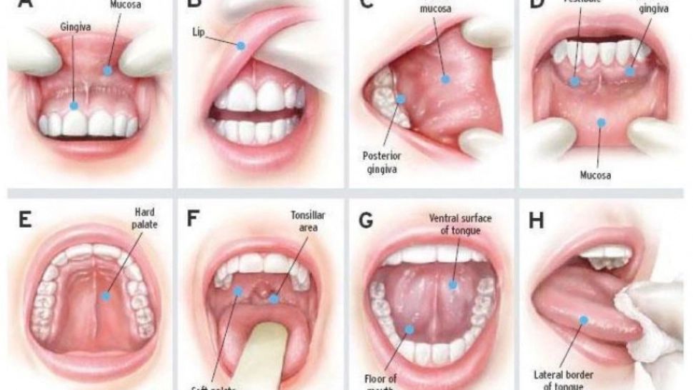 Semnele cancerului în zona capului și a gâtului care trebuie să te trimită urgent la doctor. Supraviețuirea este sub 50%