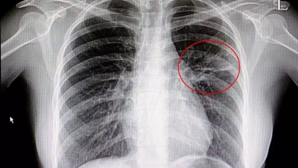 Amestecul natural din 3 plante care îţi curăţă plămânii. Şi tu le ai în casă!