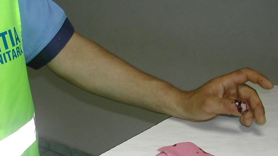 De ce a fost condamnat la 3 ani de închisoare bărbatul infectat cu HIV care a mușcat un polițist  (MOTIVARE)