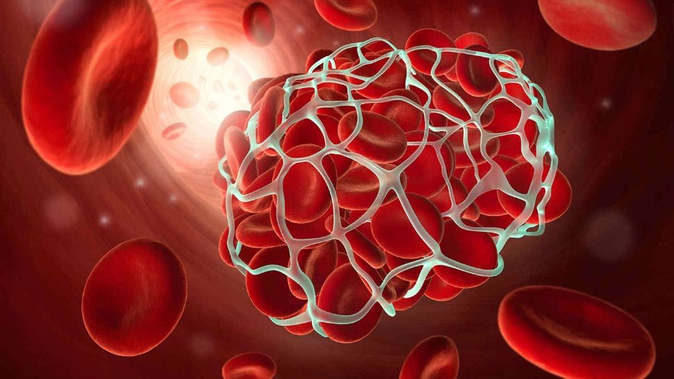 EFECTUL vaccinurilor Pfizer, Moderna și AstraZeneca la cei de peste 75 de ani - RISCUL de infarct, AVC, embolie pulmonară | STUDIU