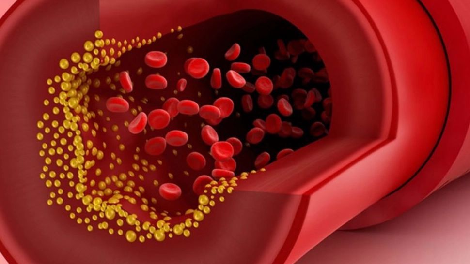 Fructul care curăță arterele și reduce nivelul de stres oxidativ