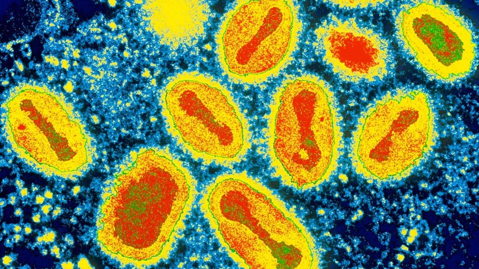 „Variola maimuțelor”, noul virus care lovește Europa. Anglia, Spania și Portugalia se confruntă deja cu primele cazuri