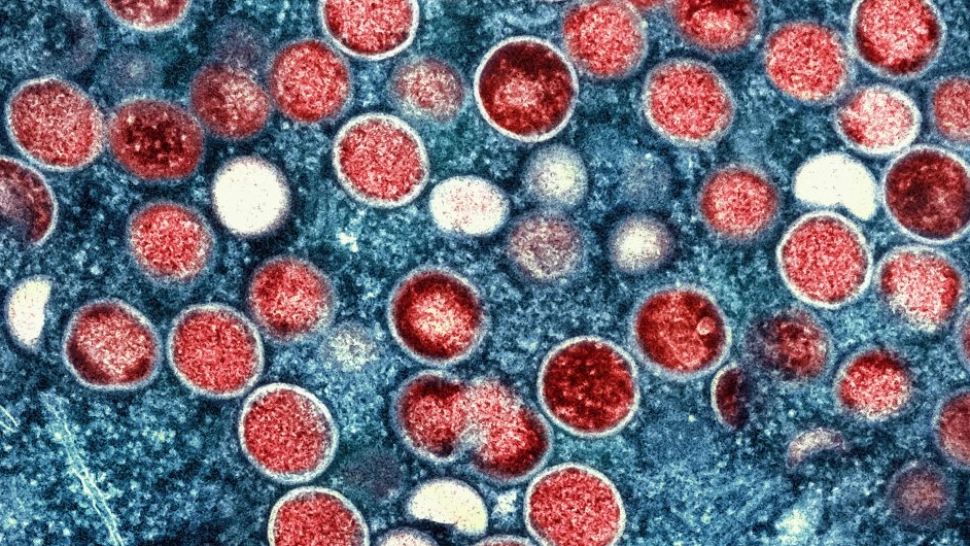 Variola maimuței ajunge în mai multe țări din Europa - Polonia confirmă primul caz: Pacientul e în spital