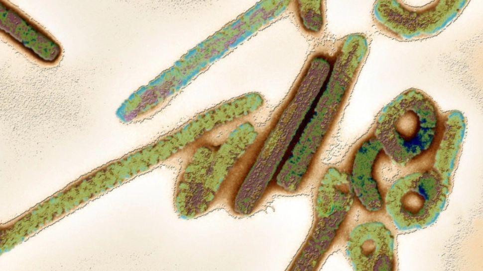 Medicii români, semnal după alerta mondială declanșată de virusul mortal Marburg - Care e pericolul pentru România