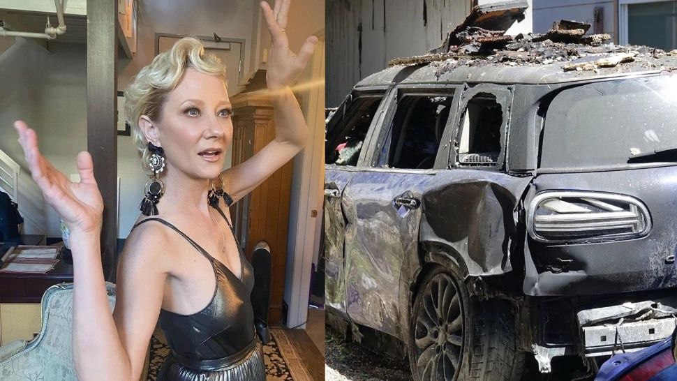 Actriță celebră de la Hollywood, ținută în viață artificial, după un accident înfiorător. A cerut ca organele să-i fie DONATE