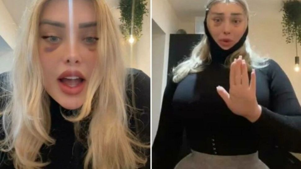 Ce a pățit o tânără care s-a urcat în avion imediat după o operație estetică. „Evident că era sânge”