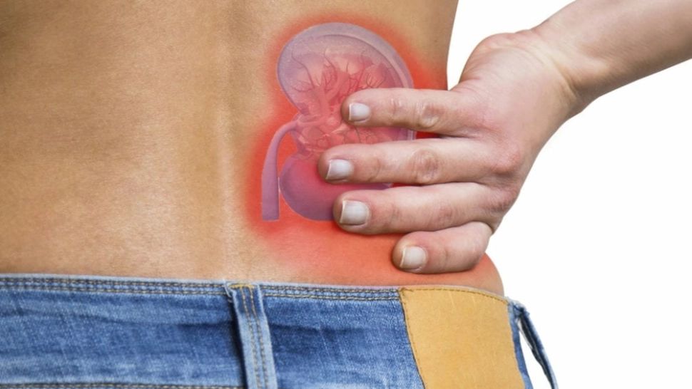 Pietrele la rinichi – de ce apar si cum le prevenim?
