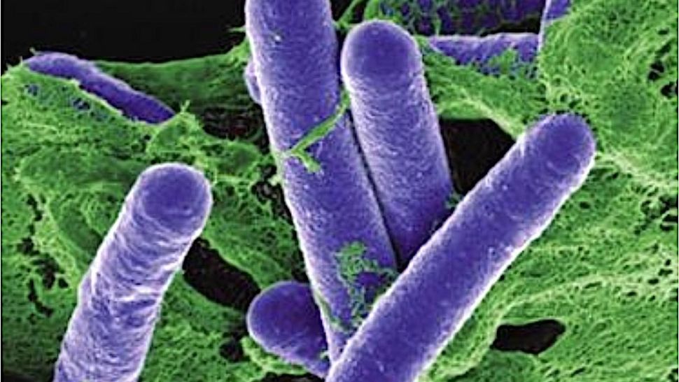 Un nou caz de botulism în România: Un bărbat de 68 de ani din Slatina, la Terapie Intensivă - De la ce alimente s-a infectat