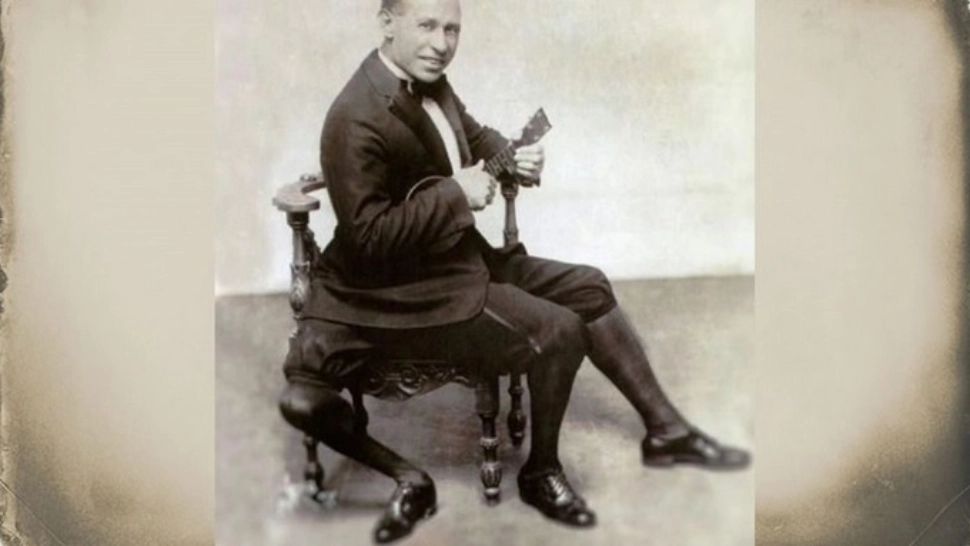 Povestea lui Frank Lentini, bărbatul cu 3 picioare care a uimit planeta 