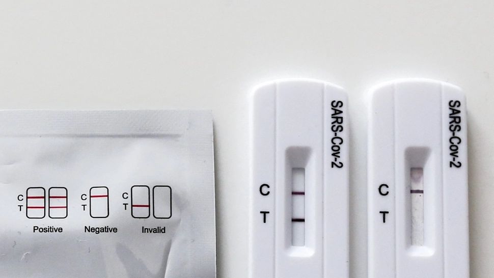 Numărul cazurilor noi de infectare cu COVID-19, în scădere: câte teste PCR au fost efectuate în ultimele 24 de ore