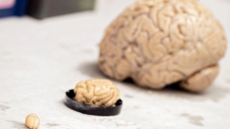 Ce se întâmplă în creier când murim. Chiar ne revedem viața pe repede înainte?