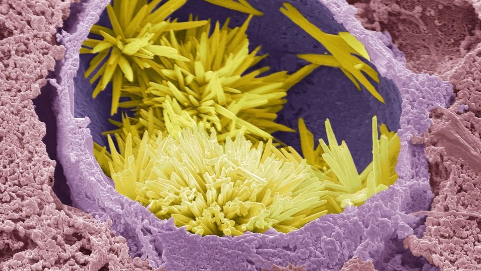 Paraziții care provoacă LEPRA pot avea și un efect benefic uluitor în refacerea hepatică