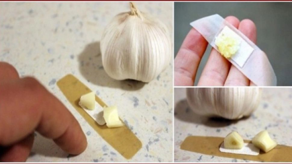 Lipeşte de piele un plasture cu o bucăţică de usturoi pe el. Efect puternic - te va ului!