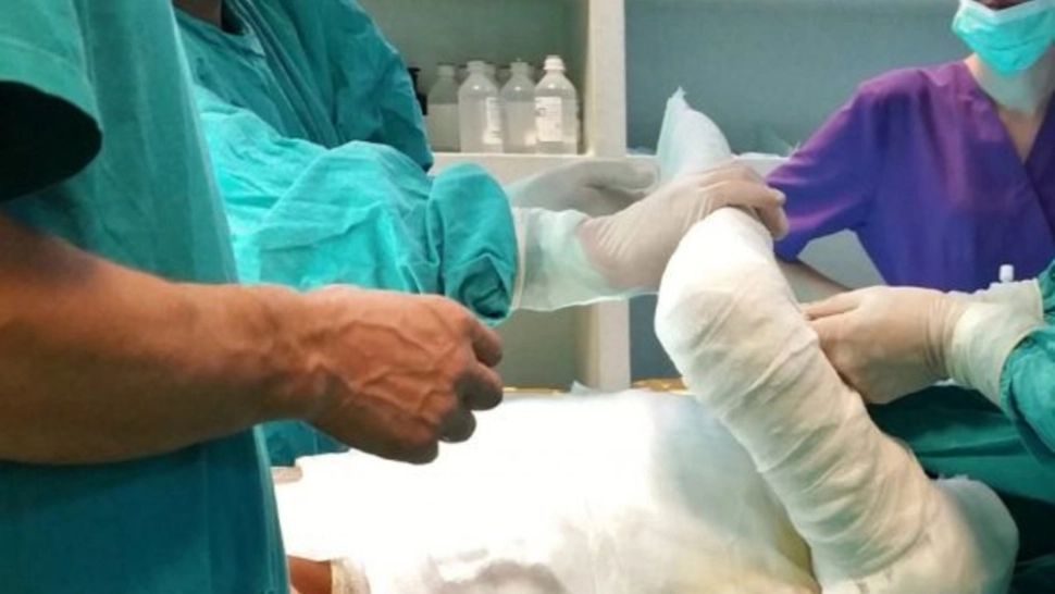 Bărbat transportat la spital cu arsuri la mâini și față! Un incendiu i-a mistuit locuința