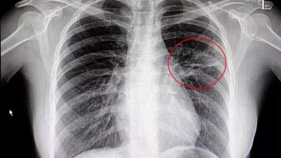 Amestecul natural din 3 plante care îţi curăţă plămânii. Şi tu le ai în casă!