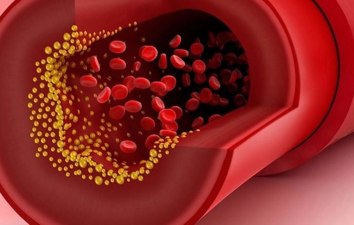 Singurul aliment care scade colesterolul și curăță vasele de sânge