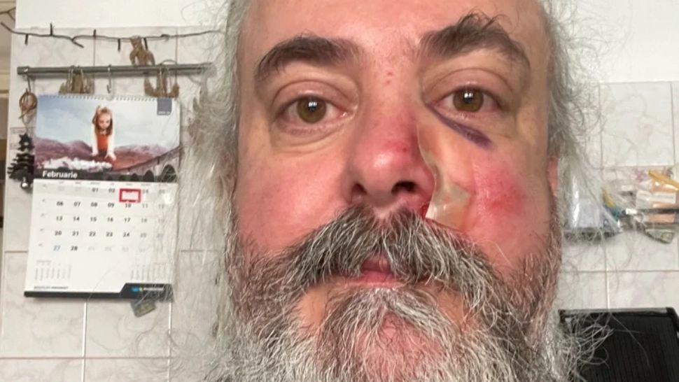 Solistul trupei Bucovina, bătut fără motiv în plină stradă. A fost lovit cu obiecte metalice de patru tineri 