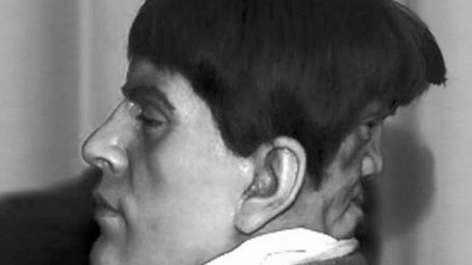 Înger şi demon. Povestea cutremurătoare a omului care s-a născut cu două feţe