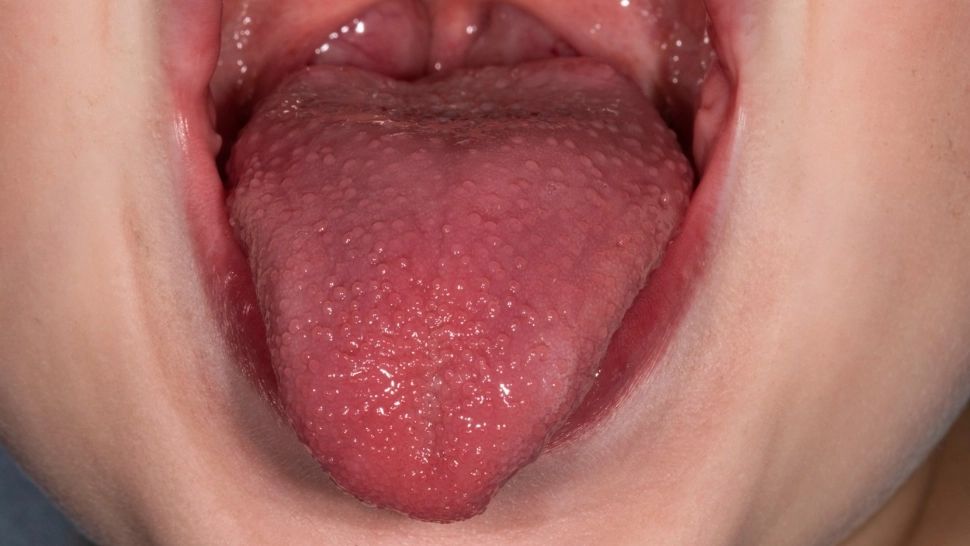 Avertisment pentru părinți. Tot mai mulți copii fac scarlatină în această perioadă