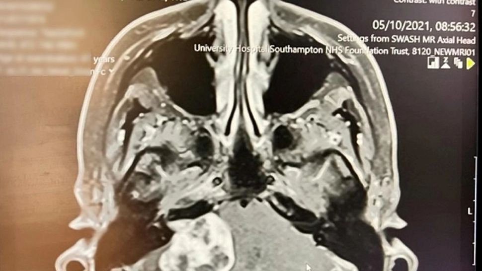 În cât timp ajung în CREIER particulele de plastic din apa potabilă - STUDIU ȘOCANT