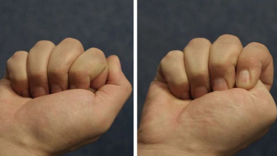 Testul care îţi spune cele mai ascunse lucruri despre tine. Tu cum strângi pumnul?